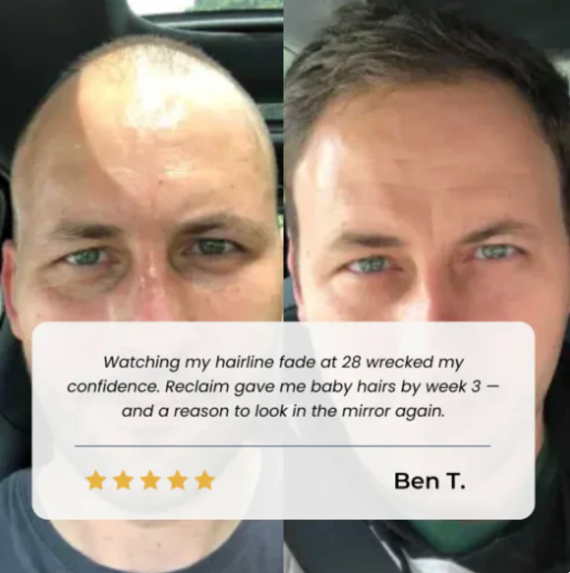 Hairgrowth™ Natural Hair Regrowth Treatment